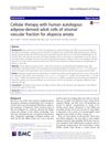 Cellular therapy with human autologous adipose-derived adult cells of stromal vascular fraction for alopecia areata