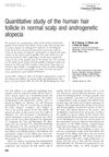 Quantitative study of the human hair follicle in normal scalp and androgenetic alopecia
