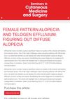 Female pattern alopecia and telogen effuvium: figuring out diffuse alopecia