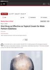 Oral Drug as Effective as Topical Cream for Male Pattern Baldness