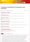 Cutaneous manifestation of polycystic ovary syndrome