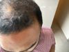 34M Seeking Advice to Restore Thick, Curly Hair