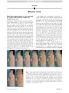 Rapid Skin Repigmentation on Oral Ruxolitinib in a Patient with Coexistent Vitiligo and Alopecia Areata