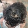 18M Noticing Thinning Crown, Family History: Is This Early Balding?