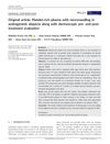 Platelet-Rich Plasma with Microneedling in Androgenetic Alopecia Along with Dermoscopic Pre- and Post-Treatment Evaluation
