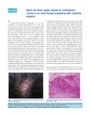Black Dot Tinea Capitis Caused by Trichophyton Rubrum in an Adult Female Presenting with Cicatricial Alopecia