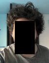 [33M] Should I proceed with MIN + DUT treatment?