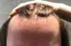 Any haircut style that can salvage this lol?