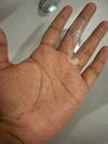 23M, switched topical solution and experiencing increased shedding