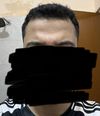 26M on Oral Fin (9 Months) &amp; Minoxidil (2-3 Years): Is There Any Improvement?