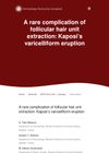 A Rare Complication of Follicular Hair Unit Extraction: Kaposi’s Varicelliform Eruption