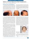 Update on Forelock Approach of Hair Transplantation