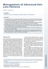Management of Advanced Hair Loss Patterns