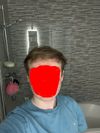 Advice on Hairstyles for Thinning Hair at 18