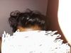 What is my hair condition? Am I Bald?