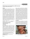 Folliculotropic Mycosis Fungoides in a Child: A Rare Case