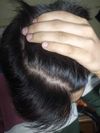 How cooked am i? (M17)
