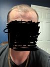 3 Months Post-Transplant: No Baby Hair Growth, On Dutasteride &amp; Minoxidil, Concerned?