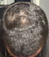 I think my hair is coming back with only 20 days?