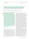 Polycystic Ovary Syndrome: Insight Into Pathogenesis and a Common Association With Insulin Resistance