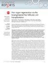 Hair Organ Regeneration Via Bioengineered Hair Follicular Unit Transplantation