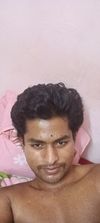 Hair loss at age of 21