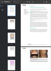 Follicular Atopic Dermatitis in Dark Skin