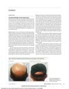 Focal Photodamage on the Occipital Scalp