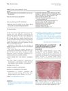 Yellow Facial Papules Associated With Frontal Fibrosing Alopecia: A Distinct Histologic Pattern and Response to Isotretinoin