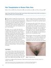 Hair Transplantation to Restore Pubic Area