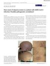 New Onset of Alopecia Areata in a Patient with SARS-CoV-2 Infection: Possible Pathogenetic Correlations
