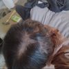 104 days of .5mg dut at 17 (read desc)