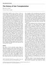 The History of Hair Transplantation