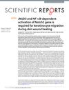 JMJD3 and NF-κB-Dependent Activation of Notch1 Gene Is Required for Keratinocyte Migration During Skin Wound Healing