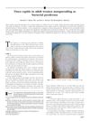 Tinea Capitis in Adult Women Masquerading as Bacterial Pyoderma
