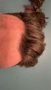 Advice on Treatment Progress for M27 with Early Hairloss