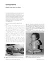 Androgenetic Alopecia: The Role of Inflammation and Demodex