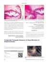 Congenital Triangular Alopecia: A Close Mimicker of Alopecia Areata