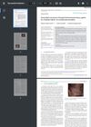 Successful Treatment of Fungal Ball-Associated Tinea Capitis in a Healthy Infant: An Unusual Presentation