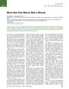 More Than One Way to Skin a Wound: A Novel Regenerative Approach for Healing Non-Healing Cutaneous Ulcers