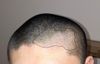One-sided diffuse thinning - what should I do?