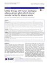 Cellular Therapy with Human Autologous Adipose-Derived Adult Cells of Stromal Vascular Fraction for Alopecia Areata