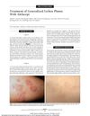 Treatment of Generalized Lichen Planus With Alefacept