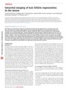 Intravital Imaging of Hair Follicle Regeneration in the Mouse