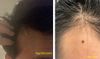 20M: Struggling with Family Hair Loss History &amp; Treatment Advice Needed