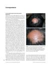 A Case of Patchy Alopecia Areata Sparing Lesional Greying Hairs