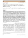 Histopathological Investigation of Clinically Non-Affected Perilesional Scalp in Alopecias Detected Unexpected Spread of Disease Activities