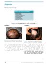 Alopecias