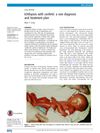 Ichthyosis With Confetti: A Rare Diagnosis And Treatment Plan