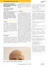 Improvement of Atopic Dermatitis and Alopecia Universalis with Dupilumab: A Case Report